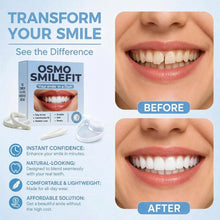 Load image into Gallery viewer, Osmo SmileFit

